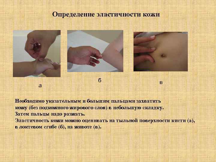    Определение эластичности кожи      б  