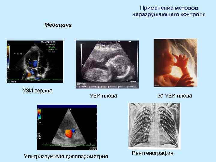 Применение методов неразрушающего Применение методов неразрушающего