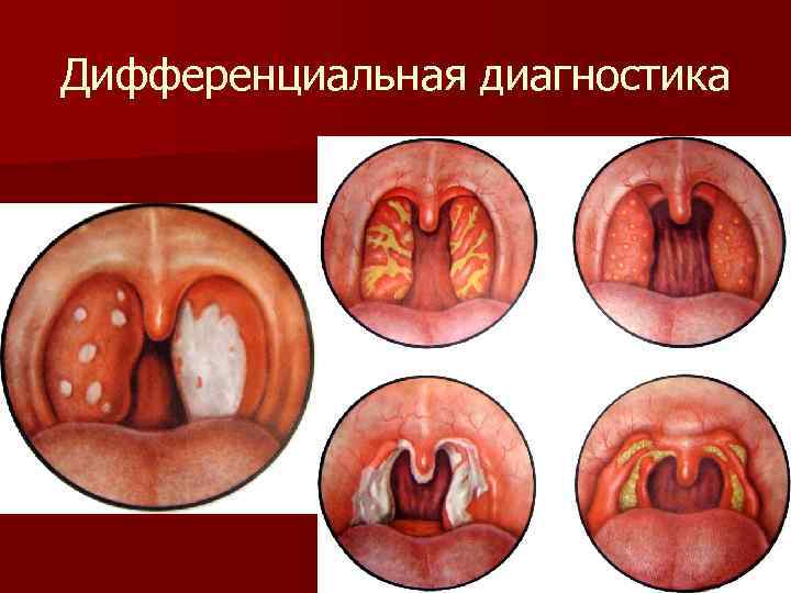 Дифференциальная диагностика 
