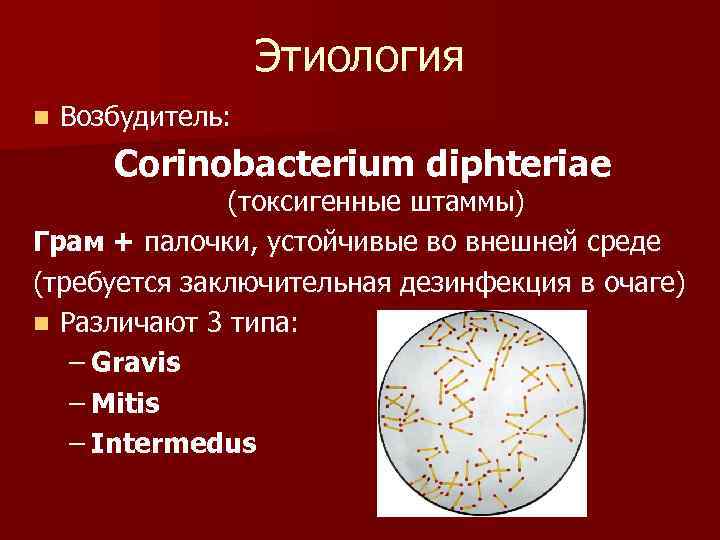      Этиология n  Возбудитель:  Corinobacterium diphteriae  
