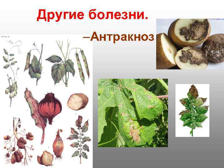 Другие болезни.  –Антракноз 
