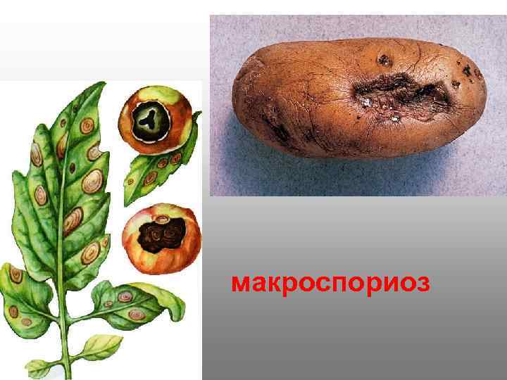 макроспориоз 