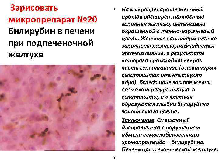 Фиброма микропрепарат рисунок