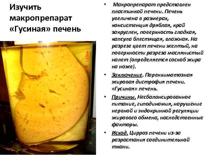 Изучить   •  Макропрепарат представлен    пластинкой печени. Печень макропрепарат