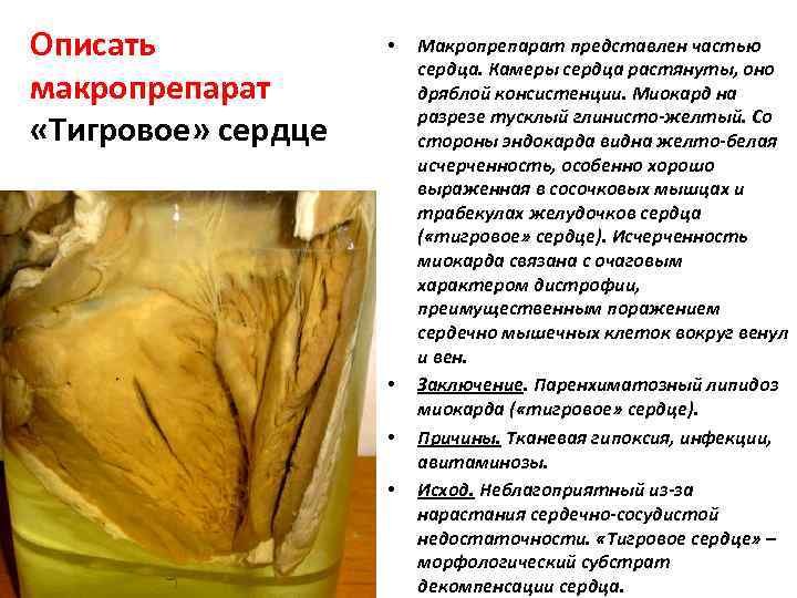 Описать   •  Макропрепарат представлен частью     сердца. Камеры