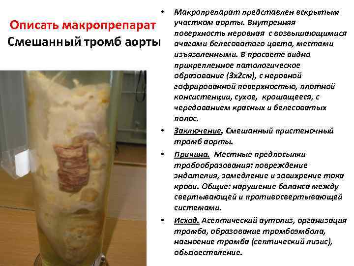      •  Макропрепарат представлен вскрытым  Описать макропрепарат 