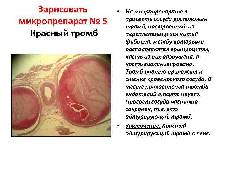   Зарисовать  • На микропрепарате в микропрепарат № 5 просвете сосуда расположен