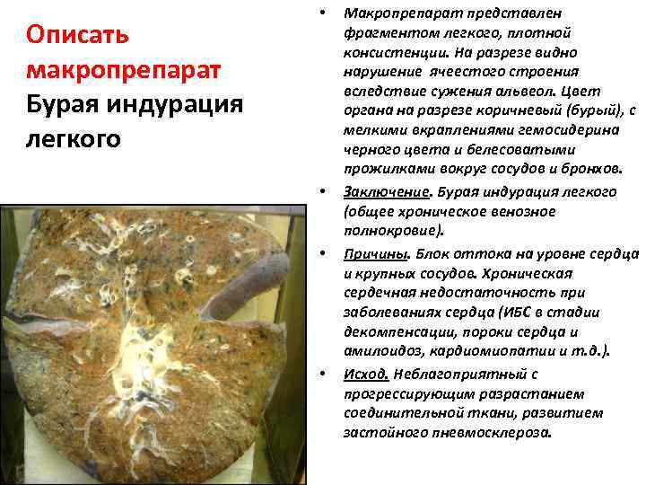     •  Макропрепарат представлен Описать    фрагментом легкого,