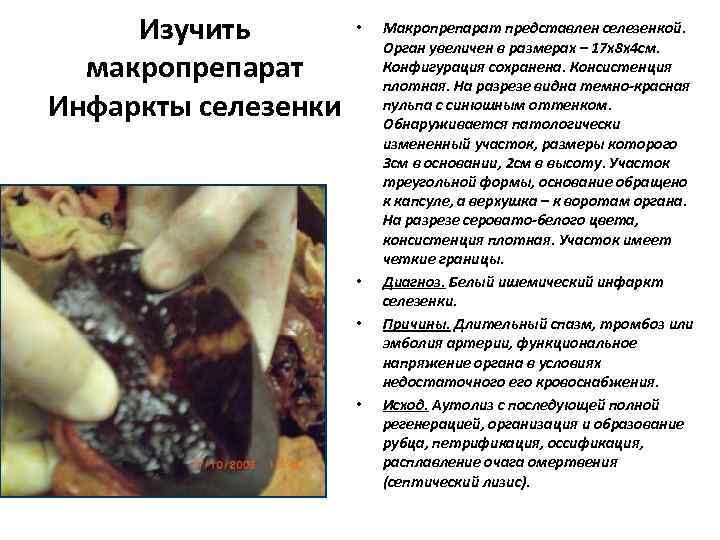  Изучить   •  Макропрепарат представлен селезенкой.     