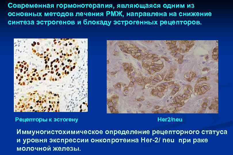 Современная гормонотерапия, являющаяся одним из основных методов лечения РМЖ, направлена на снижение синтеза эстрогенов
