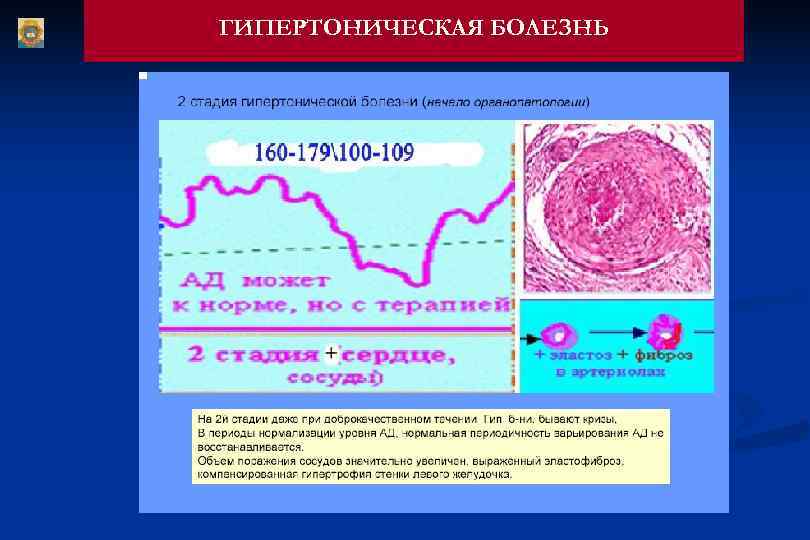 ГИПЕРТОНИЧЕСКАЯ БОЛЕЗНЬ 