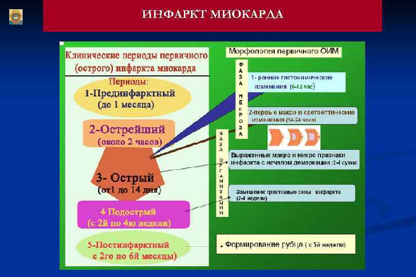 ИНФАРКТ МИОКАРДА 