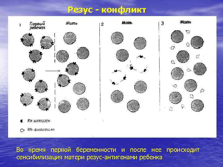 Резус - конфликт Во время первой беременности и после нее происходит Резус - конфликт Во время первой беременности и после нее происходит