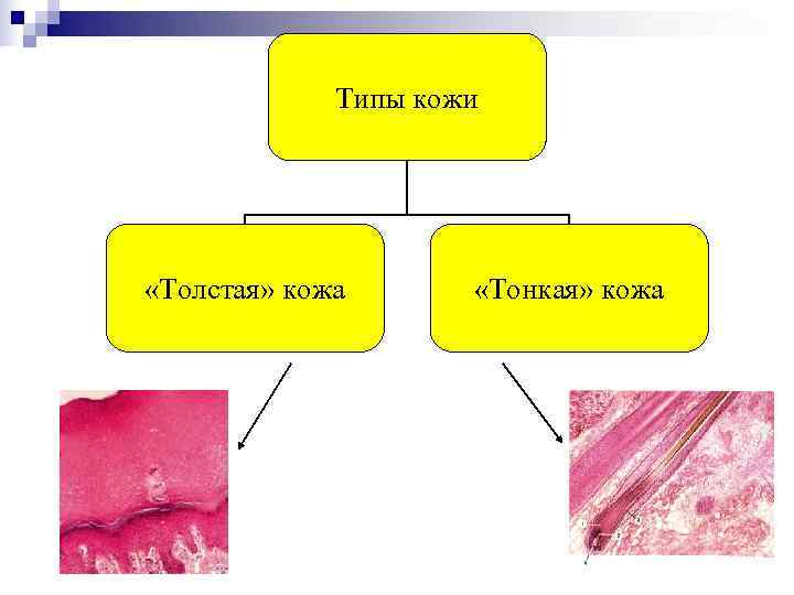    Типы кожи «Толстая» кожа  «Тонкая» кожа 
