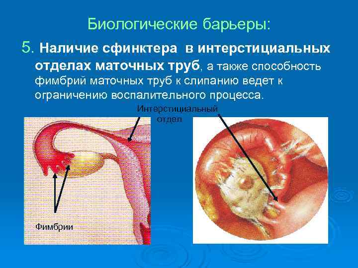 Биологические барьеры: 5. Наличие сфинктера в интерстициальных отделах маточных труб, а также Биологические барьеры: 5. Наличие сфинктера в интерстициальных отделах маточных труб, а также