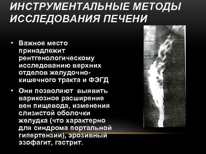 ИНСТРУМЕНТАЛЬНЫЕ МЕТОДЫ ИССЛЕДОВАНИЯ ПЕЧЕНИ  • Важное место  принадлежит  рентгенологическому  исследованию