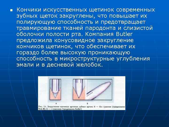 n  Кончики искусственных щетинок современных зубных щеток закруглены, что повышает их полирующую способность