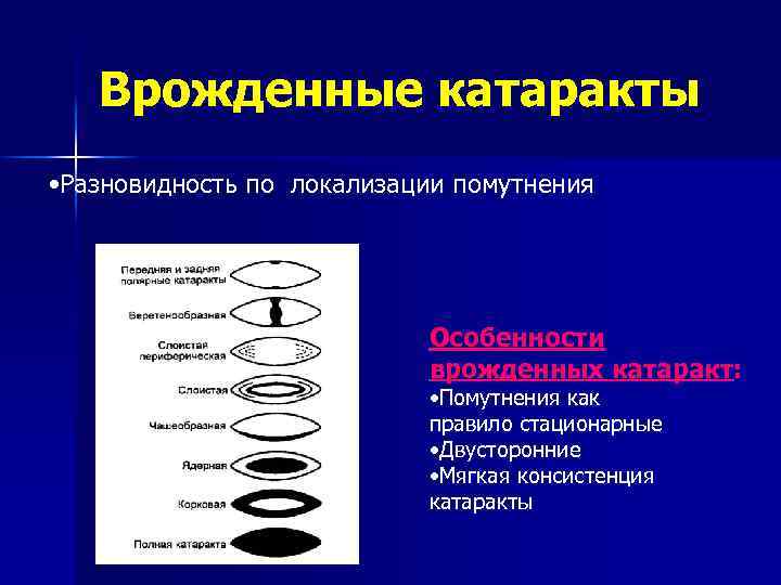 Врожденные катаракты • Разновидность по локализации помутнения Особенности врожденных катаракт: • Помутнения как правило