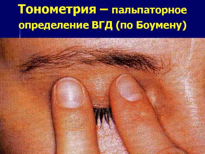 Тонометрия – пальпаторное определение ВГД (по Боумену) 