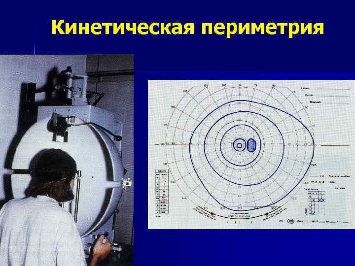 Периметрия