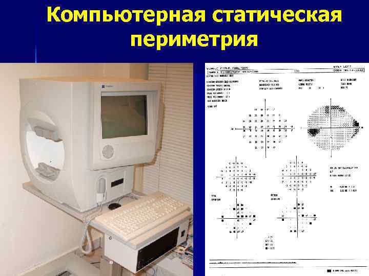 Кинетическая периметрия. Исследование полей зрения периметрия компьютерная, статическая. Компьютерная периметрия Хамфри. Поля зрения расшифровка компьютерной периметрии. Статическая периметрия норма.