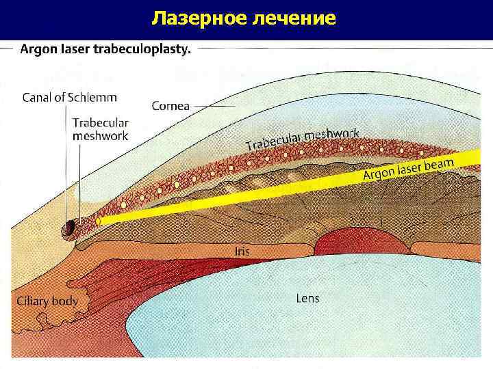 Лазерное лечение 