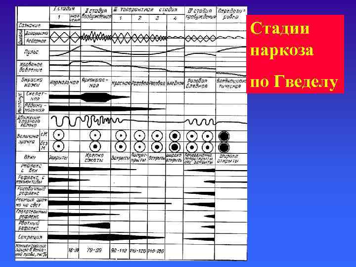 Стадии наркоза по Гведелу 