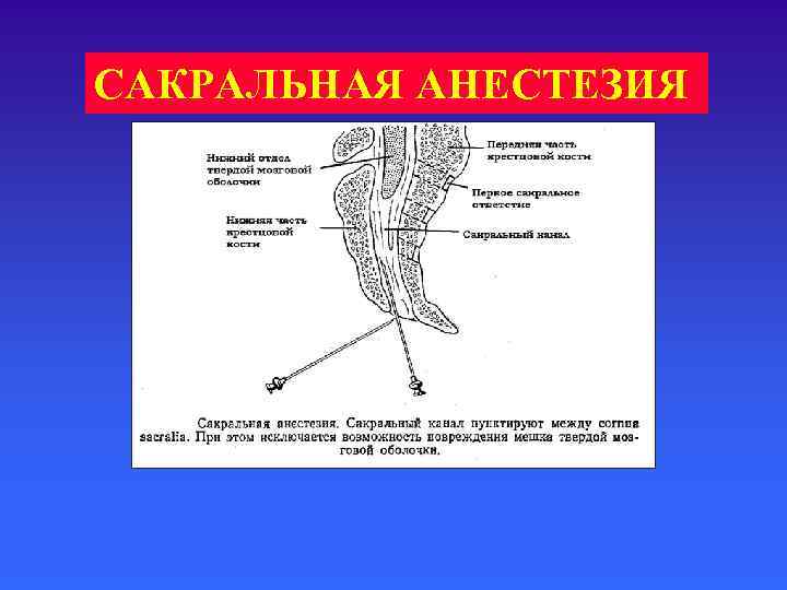 Мультимодальная анестезия презентация