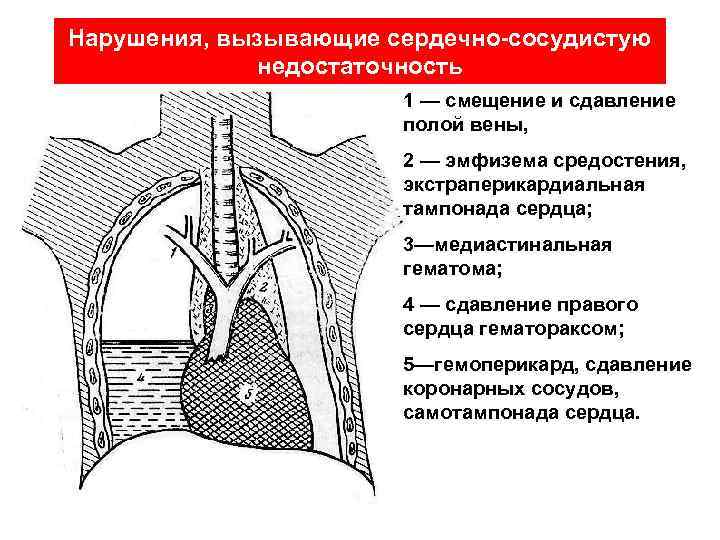 Образования средостения схема