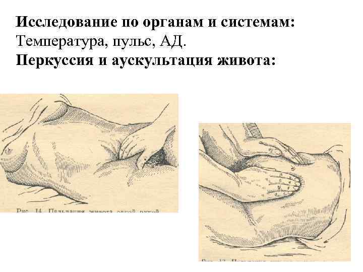 Исследование по органам и системам: Температура, пульс, АД.  Перкуссия и аускультация живота: 
