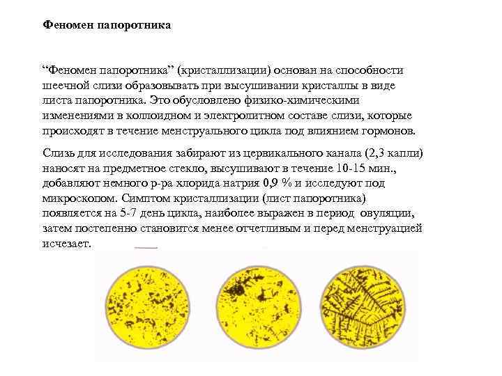 Феномен папоротника  “Феномен папоротника” (кристаллизации) основан на способности шеечной слизи образовывать при высушивании
