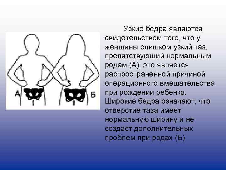    Узкие бедра являются свидетельством того, что у женщины слишком узкий таз,