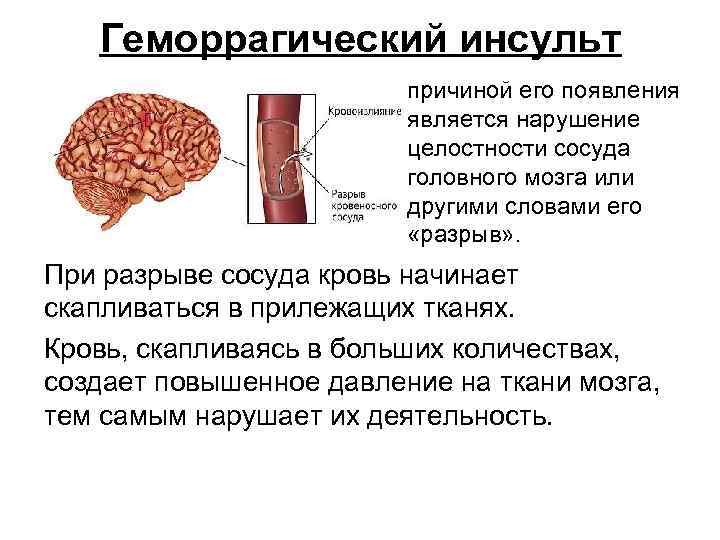   Геморрагический инсульт     причиной его появления   