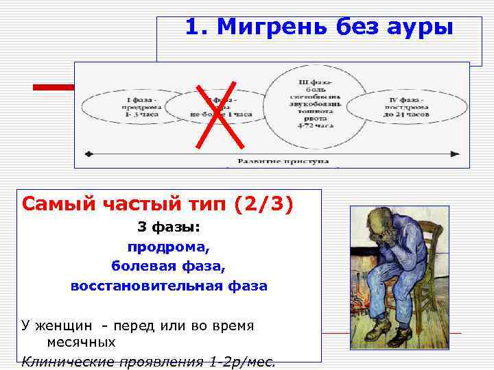     1. Мигрень без ауры Самый частый тип (2/3)  