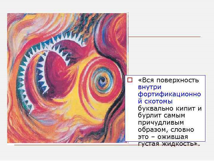 o «Вся поверхность  внутри  фортификационно  й скотомы  буквально кипит и