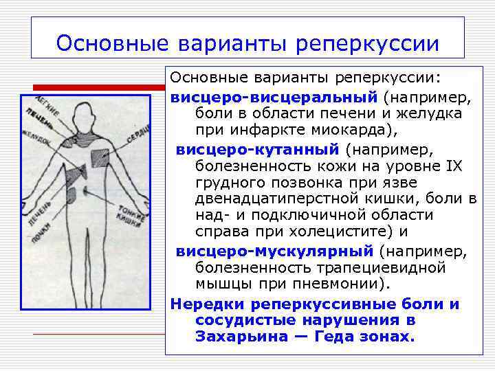 Основные варианты реперкуссии   Основные варианты реперкуссии:   висцеро-висцеральный (например,  