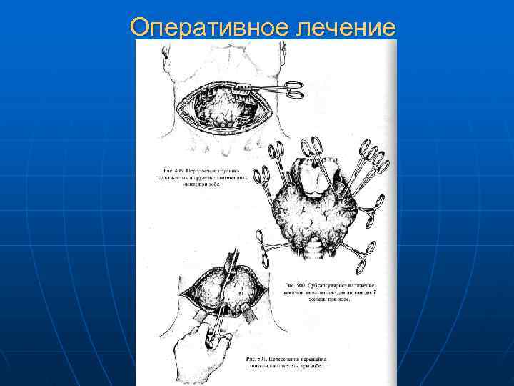 Оперативное лечение 