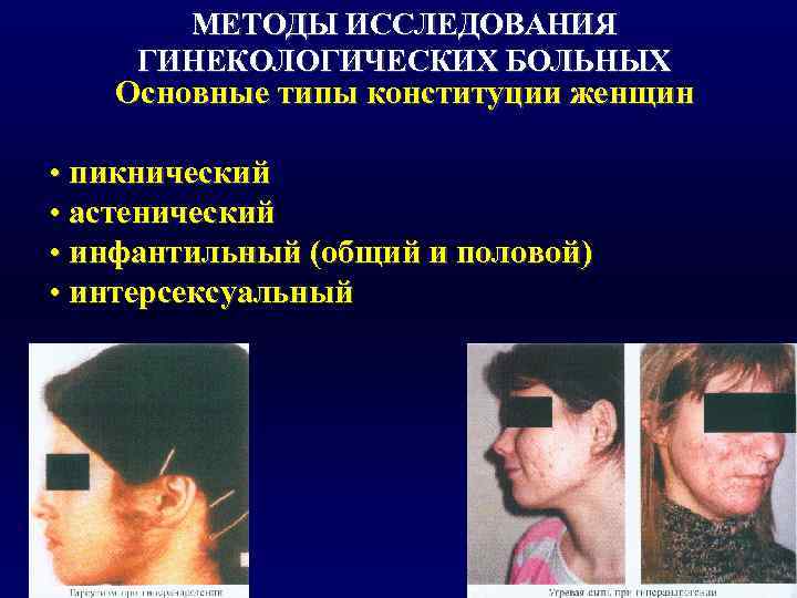   МЕТОДЫ ИССЛЕДОВАНИЯ ГИНЕКОЛОГИЧЕСКИХ БОЛЬНЫХ  Основные типы конституции женщин  • пикнический