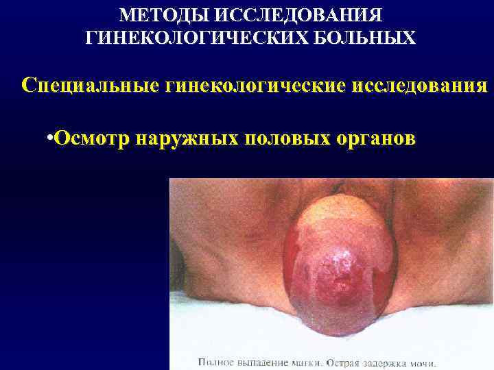   МЕТОДЫ ИССЛЕДОВАНИЯ ГИНЕКОЛОГИЧЕСКИХ БОЛЬНЫХ Специальные гинекологические исследования • Осмотр наружных половых органов