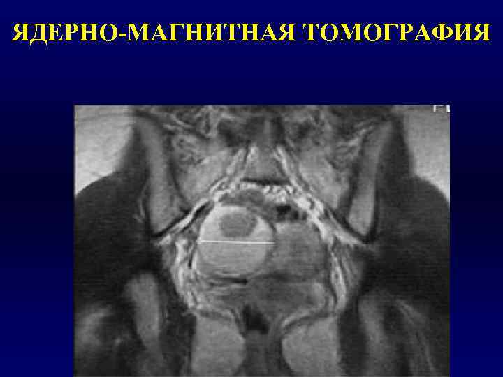 ЯДЕРНО-МАГНИТНАЯ ТОМОГРАФИЯ 