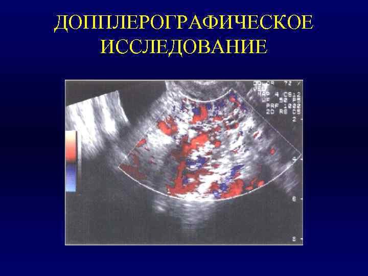 ДОППЛЕРОГРАФИЧЕСКОЕ  ИССЛЕДОВАНИЕ 