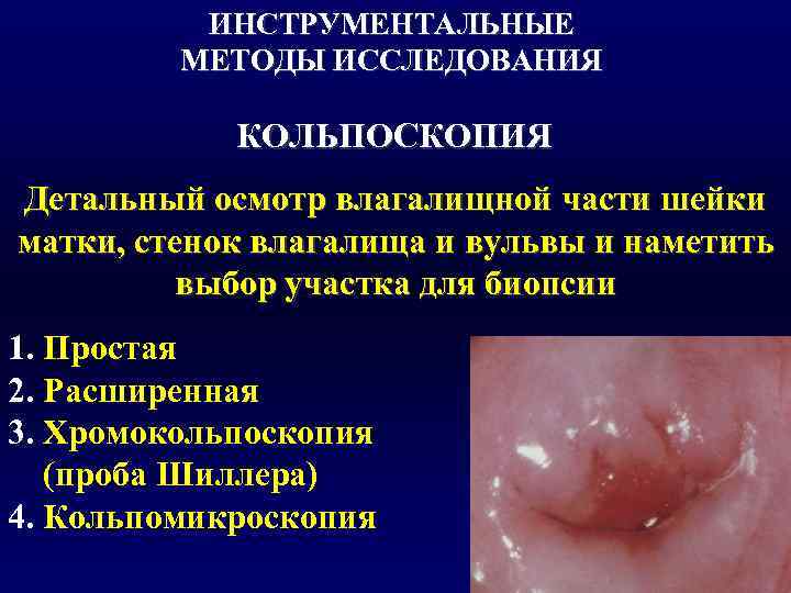    ИНСТРУМЕНТАЛЬНЫЕ   МЕТОДЫ ИССЛЕДОВАНИЯ   КОЛЬПОСКОПИЯ Детальный осмотр влагалищной