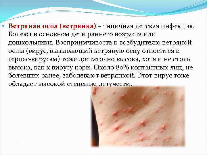 • Ветряная оспа (ветрянка) – типичная детская инфекция. Болеют в основном дети раннего • Ветряная оспа (ветрянка) – типичная детская инфекция. Болеют в основном дети раннего