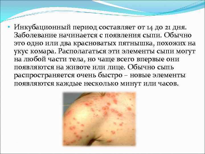 • Инкубационный период составляет от 14 до 21 дня. Заболевание начинается с появления • Инкубационный период составляет от 14 до 21 дня. Заболевание начинается с появления