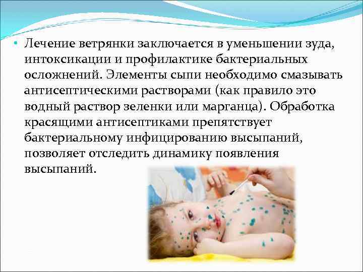 • Лечение ветрянки заключается в уменьшении зуда, интоксикации и профилактике бактериальных осложнений. • Лечение ветрянки заключается в уменьшении зуда, интоксикации и профилактике бактериальных осложнений.