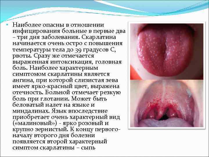 • Наиболее опасны в отношении инфицирования больные в первые два – • Наиболее опасны в отношении инфицирования больные в первые два –