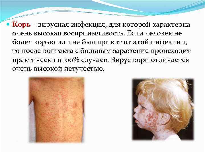 Корь – вирусная инфекция, для которой характерна очень высокая восприимчивость. Если человек Корь – вирусная инфекция, для которой характерна очень высокая восприимчивость. Если человек