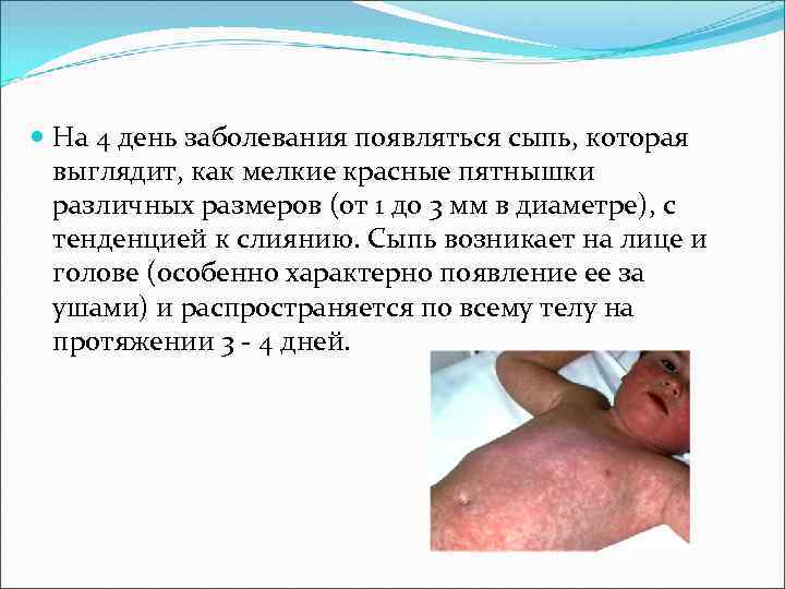 На 4 день заболевания появляться сыпь, которая выглядит, как мелкие красные пятнышки На 4 день заболевания появляться сыпь, которая выглядит, как мелкие красные пятнышки