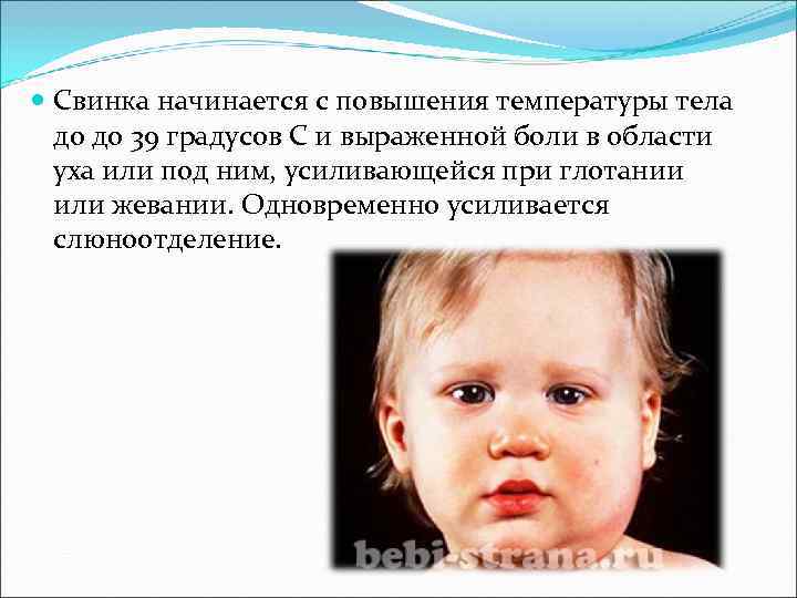 Свинка начинается с повышения температуры тела до до 39 градусов С и Свинка начинается с повышения температуры тела до до 39 градусов С и