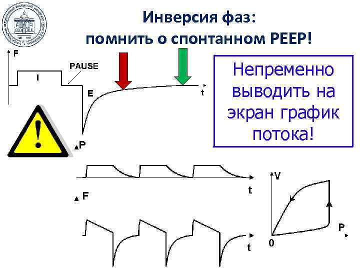  Инверсия фаз: помнить о спонтанном РЕЕР!   Непременно   выводить на